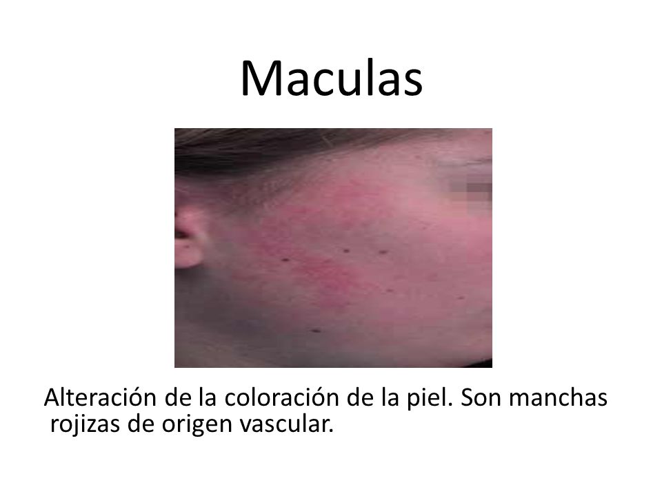 La crema el euforbio que blanquea las revocaciones